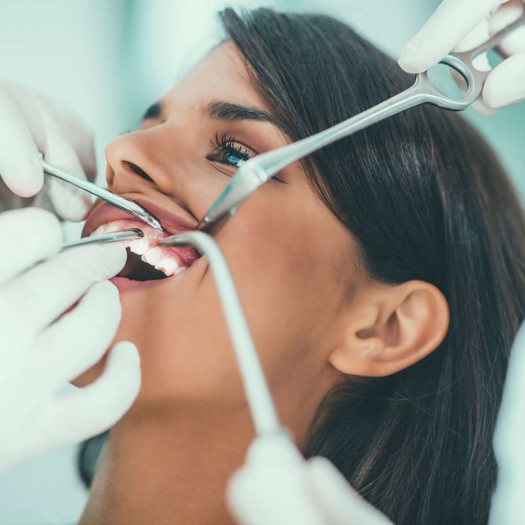 tooth extraction (12)