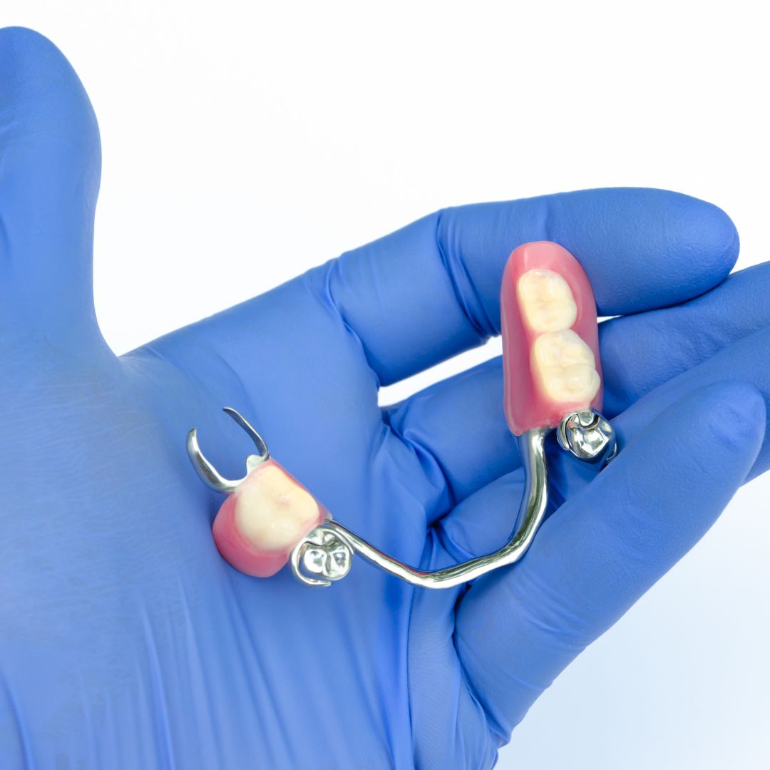 tooth extraction (15)