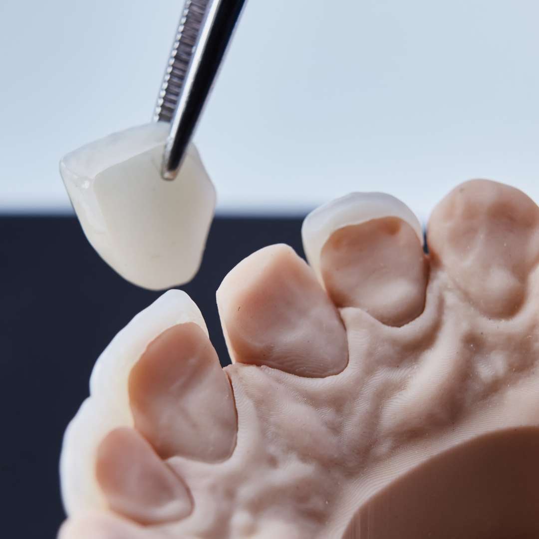 tooth extraction (19)