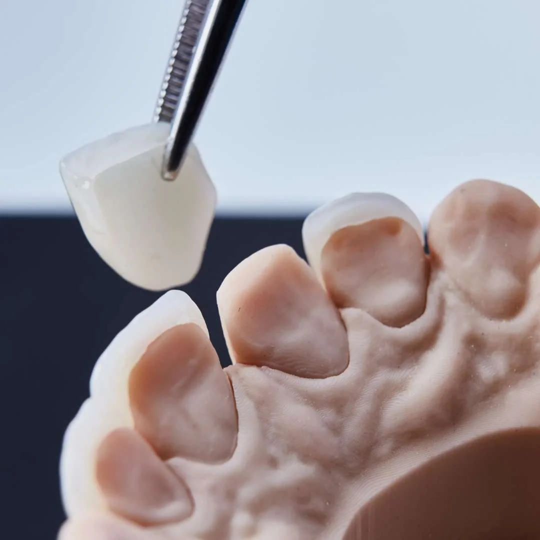 tooth extraction (19)