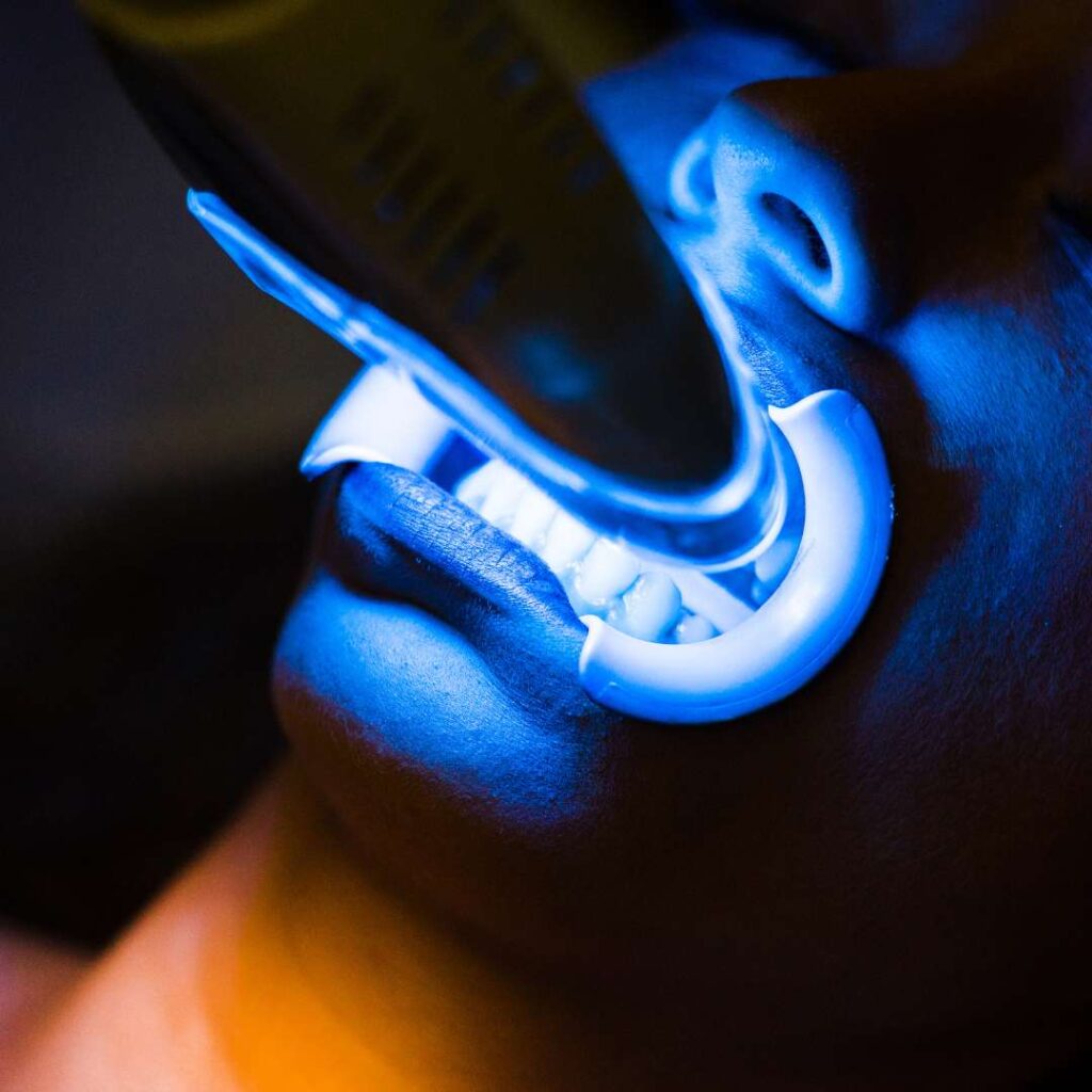 tooth extraction (22)