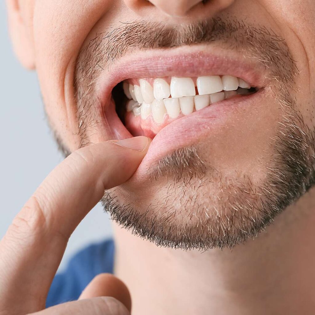 tooth extraction (27)