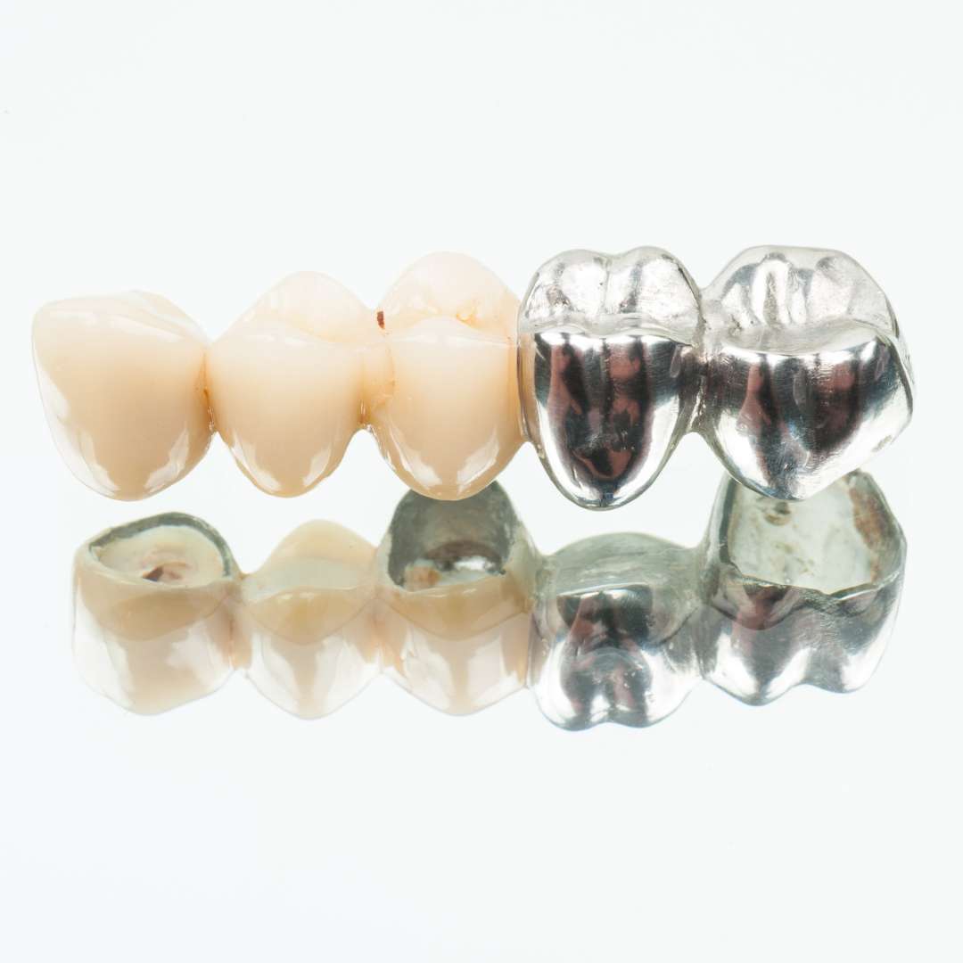 tooth extraction (30)