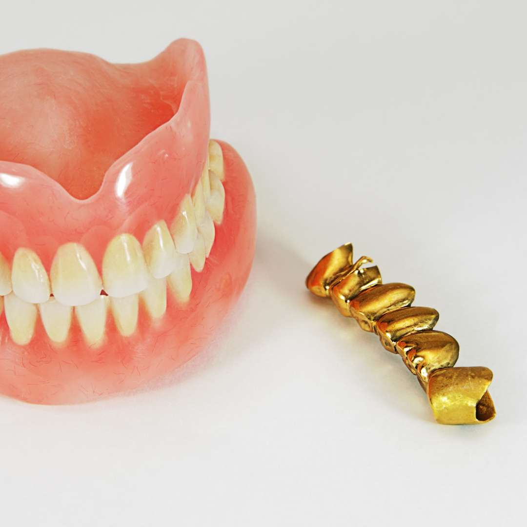 tooth extraction (32)