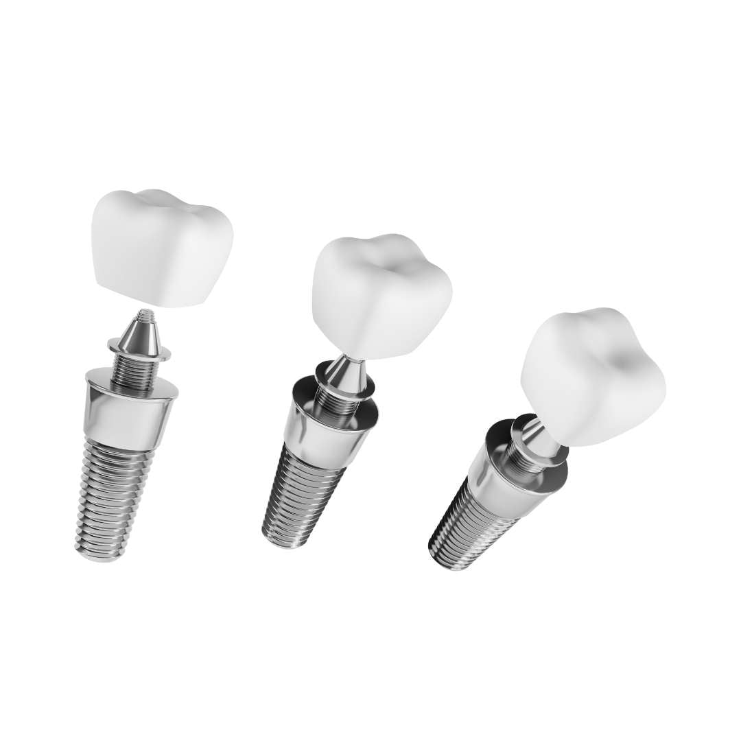 tooth extraction (41)