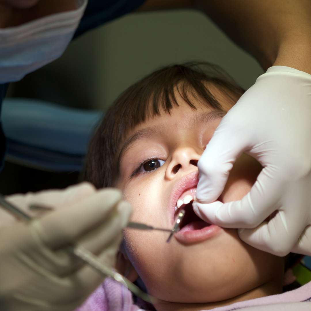 tooth extraction (54)