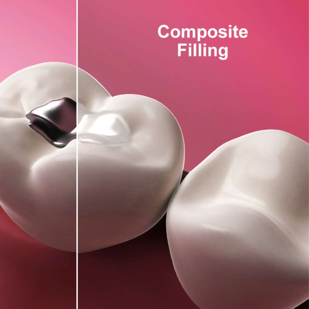 tooth extraction